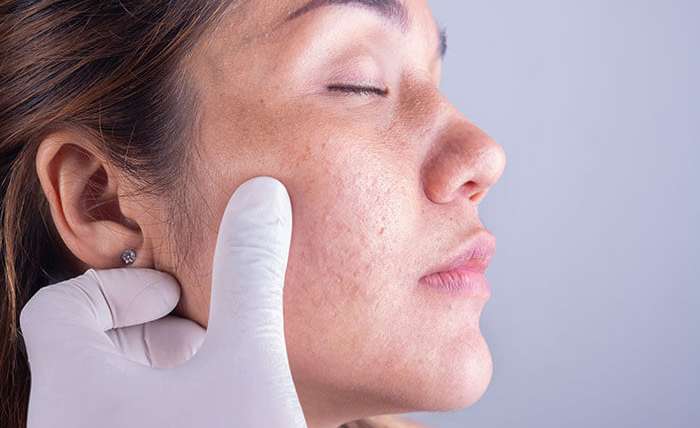 Best Skin Aesthetician in Islamabad